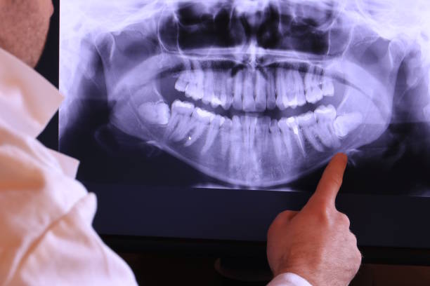 Best Emergency Treatment for Dental Infections or Abscesses in Munday, TX
