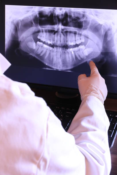 Best Emergency Dental Care for Broken or Chipped Teeth in Munday, TX
